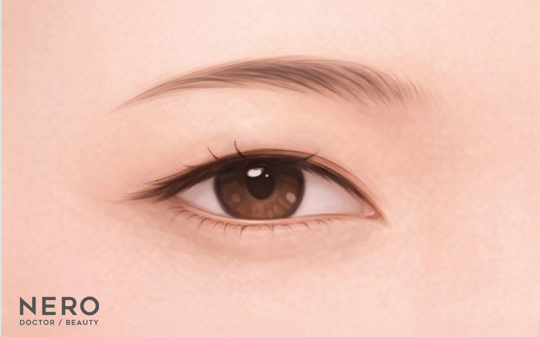 まぶたのたるみ取りは埋没だけじゃ限界?埋没と切開どっちがいいか悩む方に…ナチュラルな二重切開という新しい選択肢【オーキッド美容クリニック東京御徒町】