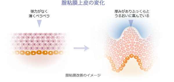 腟デバイス大全―RF・HIFU・CO2・Er:YAGを科学的に比較する｜NERO DOCTOR / BEAUTY（美容医療）