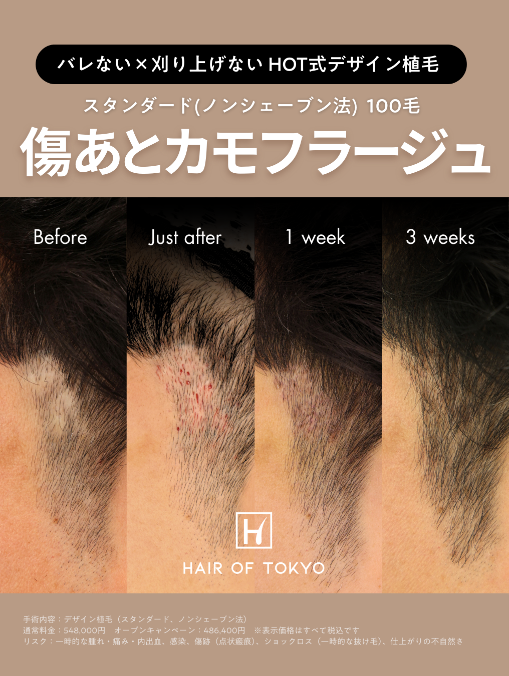 生え際後退の原因は加齢だけじゃない？｜NERO DOCTOR / BEAUTY（美容医療）