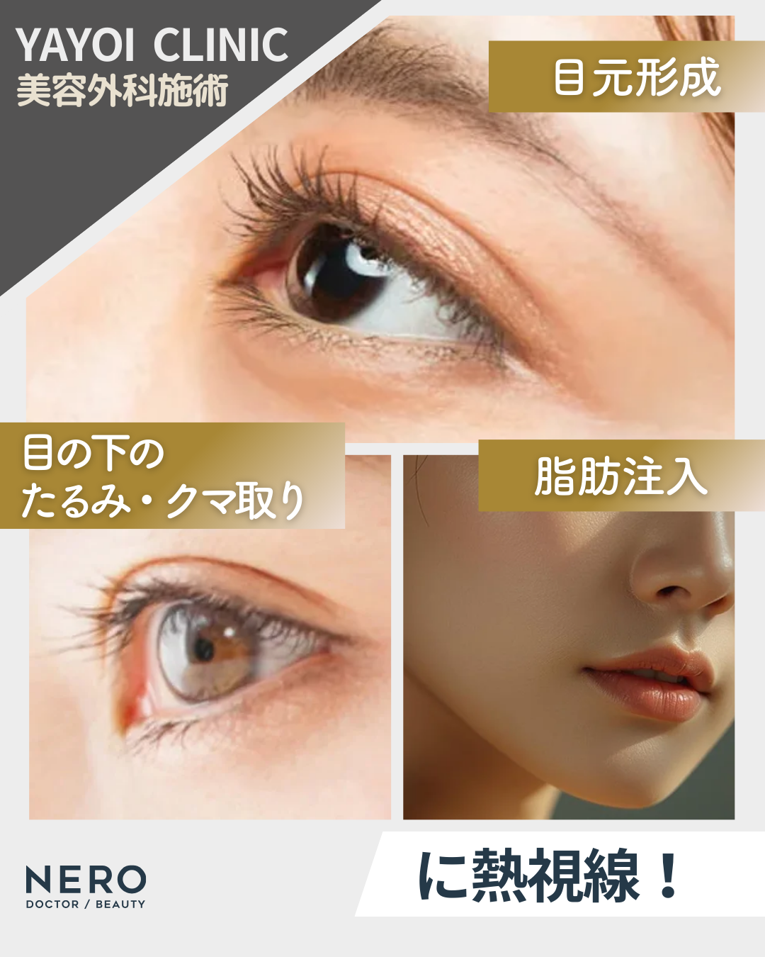 広島YAYOI CLINICの美容外科『毎週外科day』に注目！おすすめされる理由と施術内容