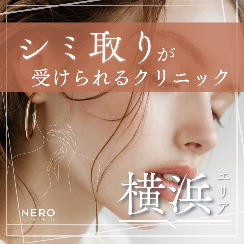 横浜でシミ取り治療が受けられるクリニック11院｜治療法や後悔しないための比較ポイント