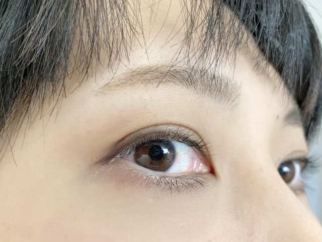 二重幅が広すぎて変？「ハム目っぽく見える原因」と似合う幅の決め方