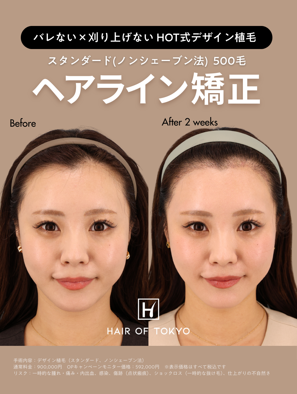 生え際後退の原因は加齢だけじゃない？｜NERO DOCTOR / BEAUTY（美容医療）