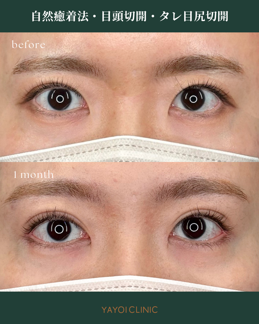 広島YAYOI CLINICの美容外科『毎週外科day』に注目！おすすめされる理由と施術内容