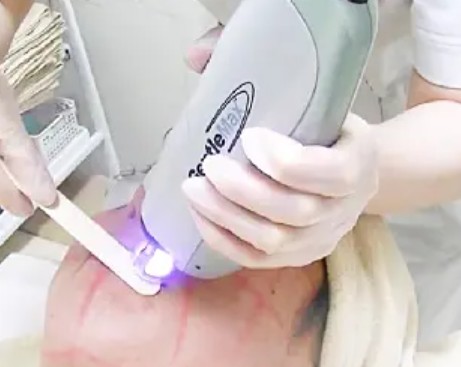 メンズ脱毛を大宮で!VIO・ひげ医療脱毛の効果とクリニック10選|NERO美容医療