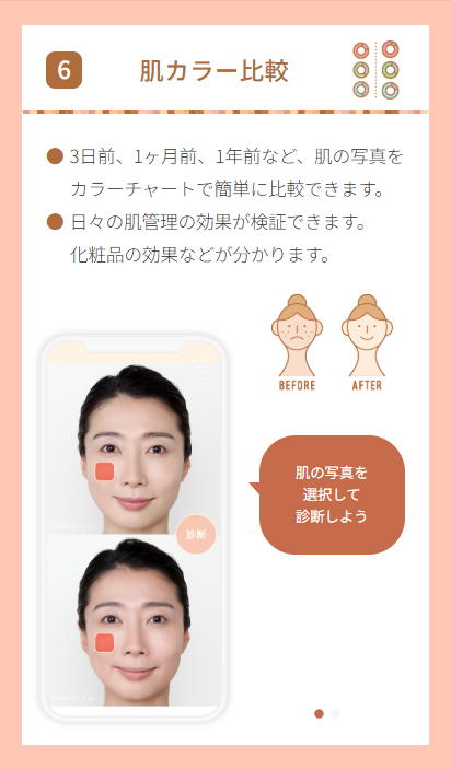 ニキビの治し方は自宅での再現性がカギ！最短3ヶ月での実感を目指す滋賀・ふくなが皮膚科の治療方針とは