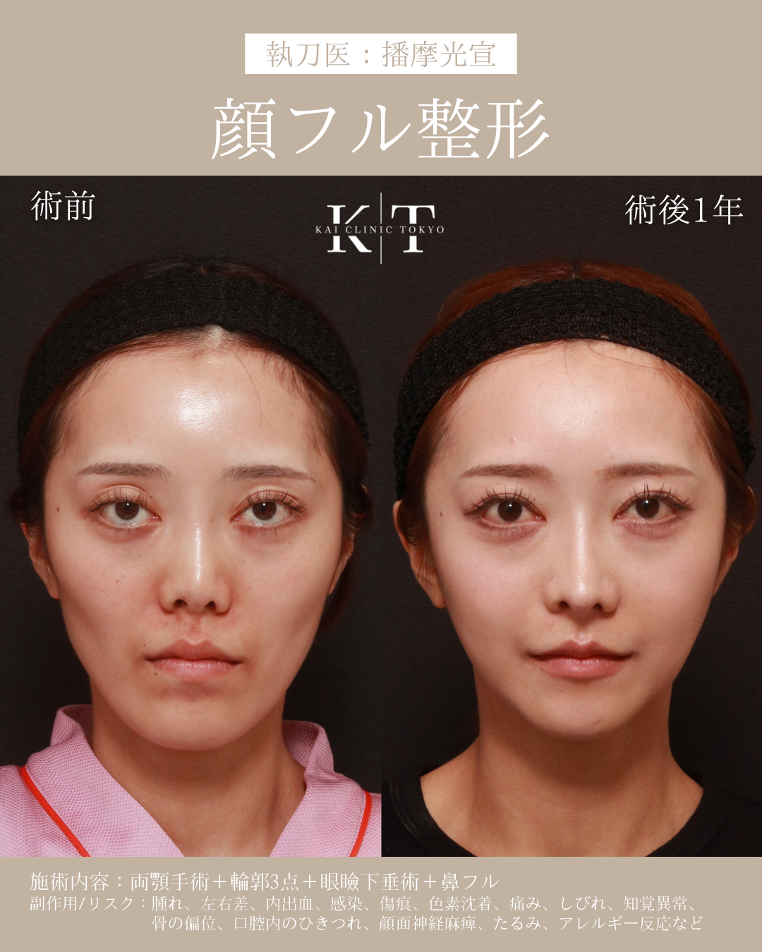 本気で顔を小さくしたい!骨格のプロが解説|NERO DOCTOR / BEAUTY(美容医療)