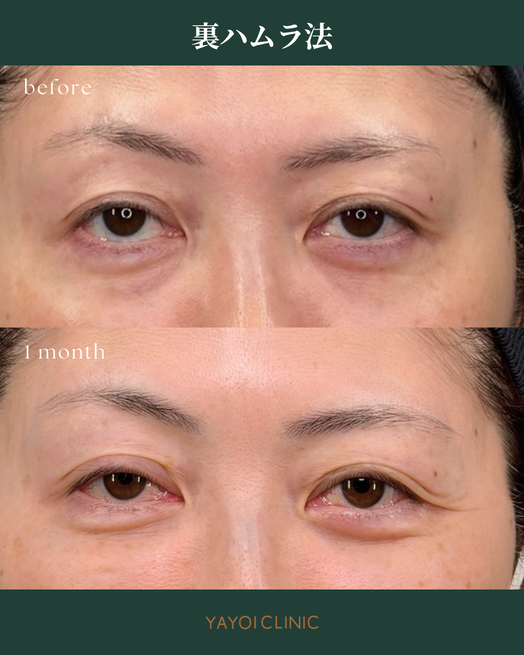 広島YAYOI CLINICの美容外科『毎週外科day』に注目！おすすめされる理由と施術内容