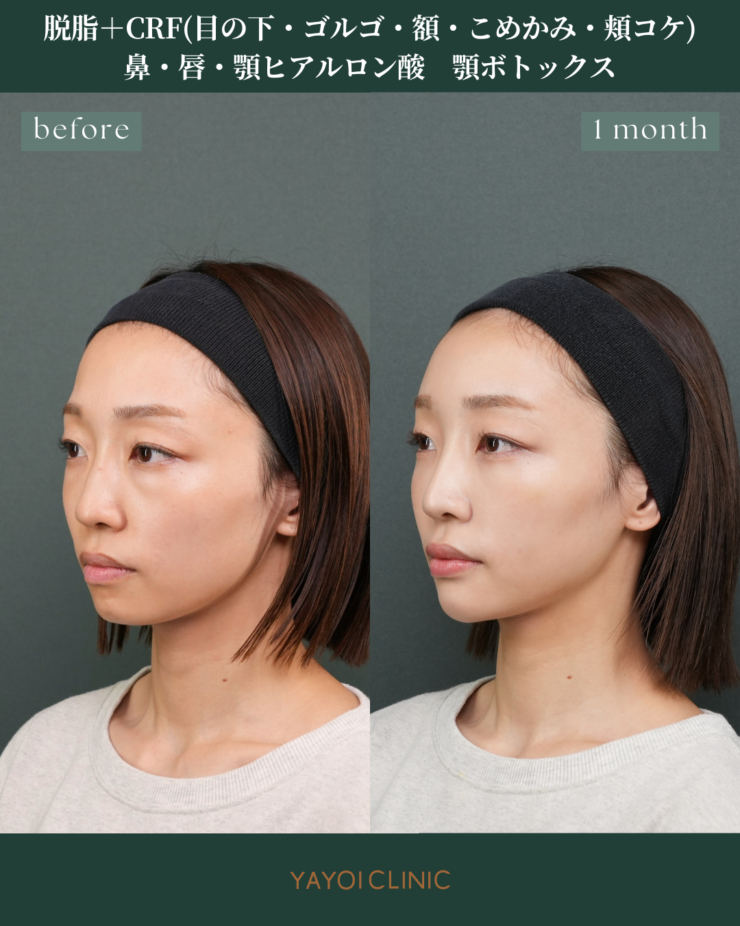 広島YAYOI CLINICの美容外科『毎週外科day』に注目！おすすめされる理由と施術内容