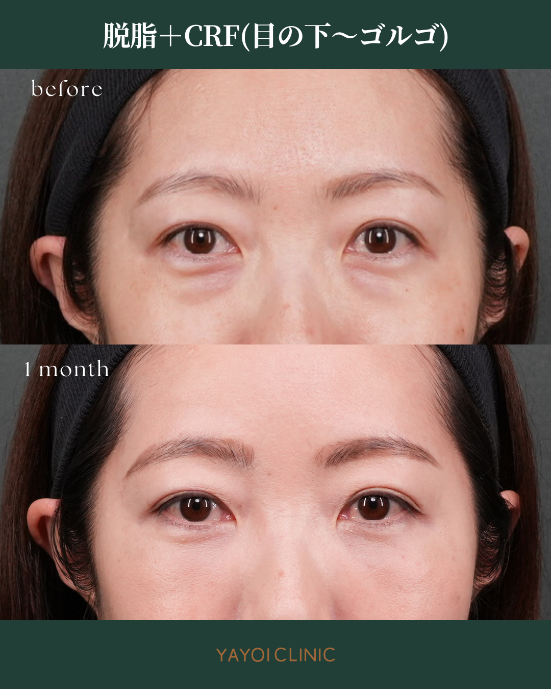 広島YAYOI CLINICの美容外科『毎週外科day』に注目！おすすめされる理由と施術内容