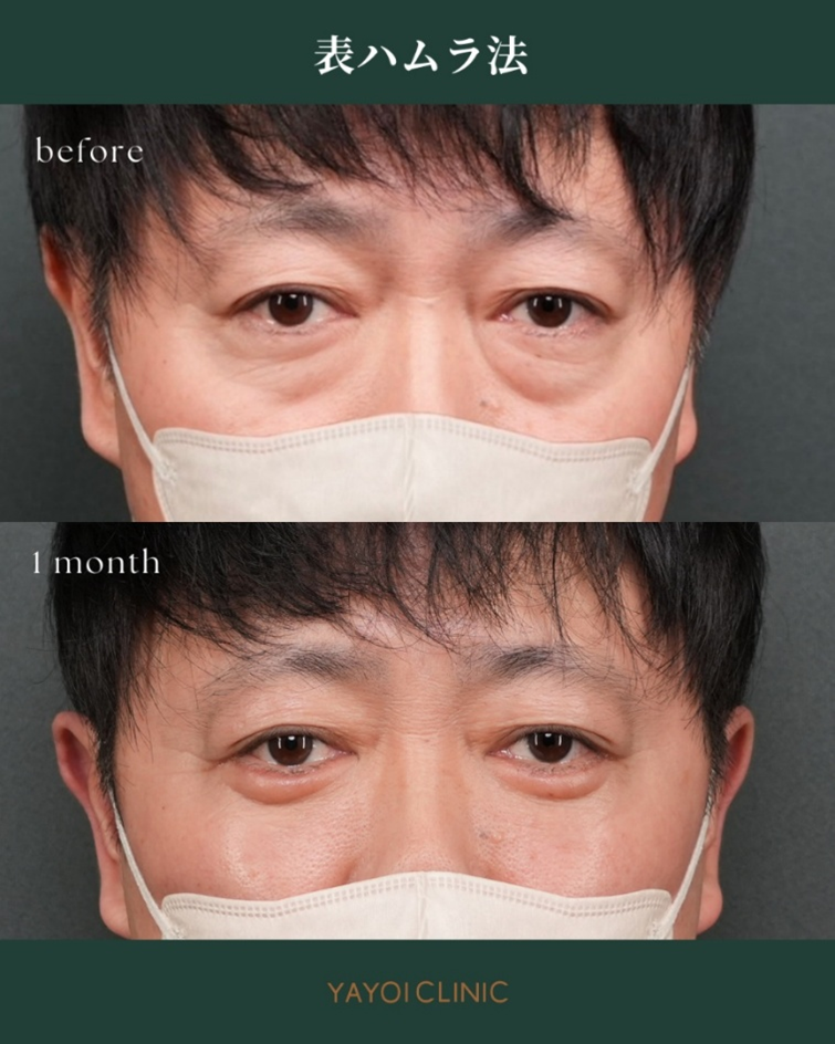 広島YAYOI CLINICの美容外科『毎週外科day』に注目！おすすめされる理由と施術内容