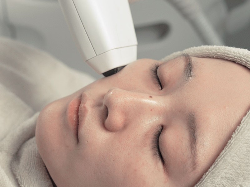 ソフウェーブを東京で受けるなら|コントアクリニック東京が提案する“たるみ×シワ×肌質”の全方位ケア