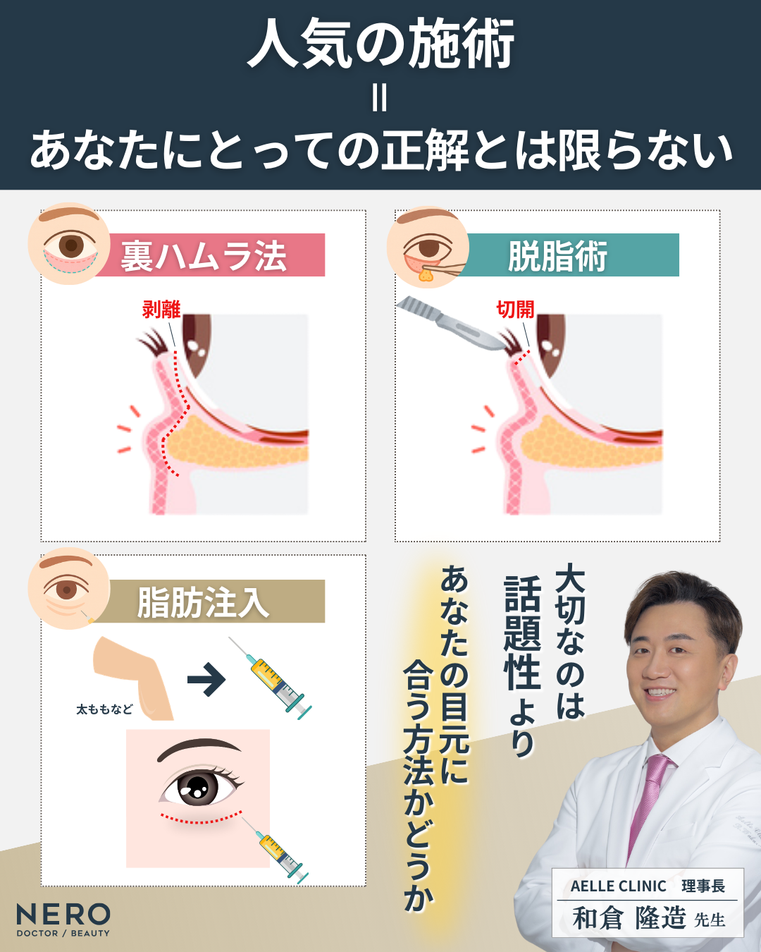 目の下の脂肪取り、どの方法が正解？たるみ別の対処法をアエルクリニック和倉理事長に聞いた！