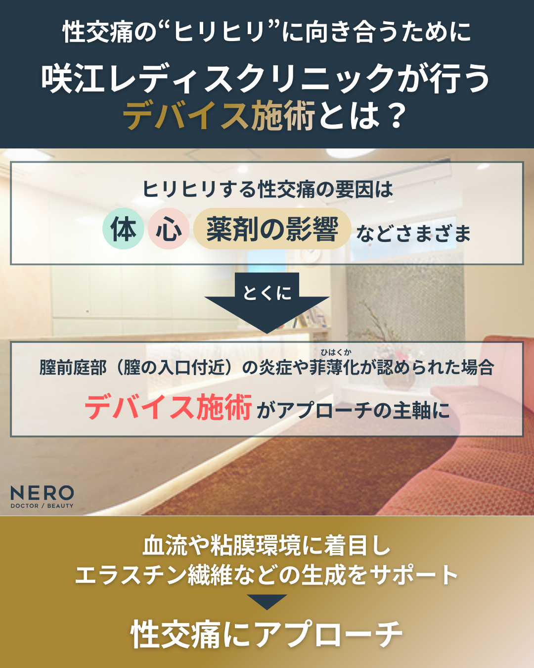 性交痛のヒリヒリへの先進施術を徹底比較―モナリザタッチ・フェムフロー・モナフローⓇ・ヨニRF……何がどう違う?【名古屋・咲江レディスクリニック 丹羽院長監修】
