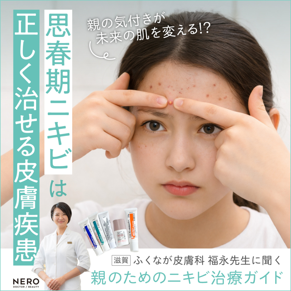 思春期ニキビの治し方は？滋賀・ふくなが皮膚科に聞く親が知っておくべきポイント