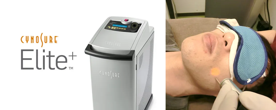 メンズ医療脱毛が受けられる金沢エリアのクリニック8選｜後悔しない選び方も解説｜NERO DOCTOR / BEAUTY（美容医療）