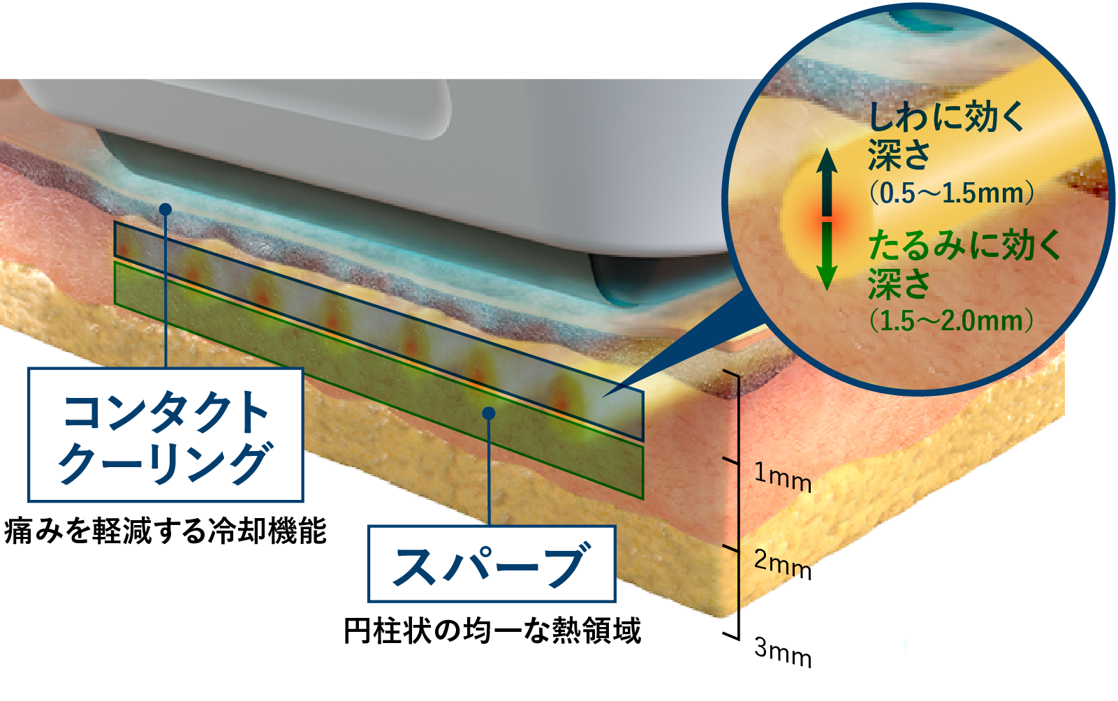 ソフウェーブを東京で受けるなら|コントアクリニック東京が提案する“たるみ×シワ×肌質”の全方位ケア