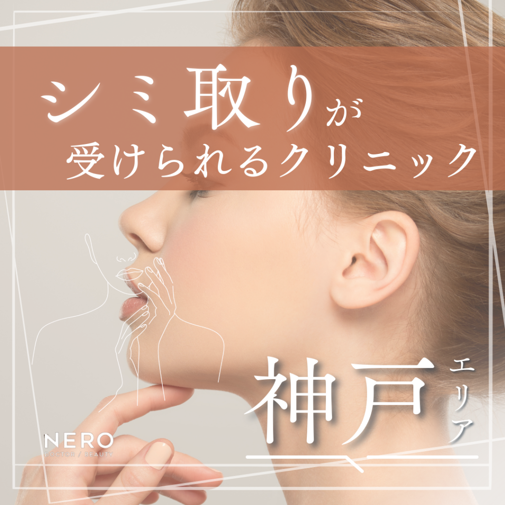 【シミ取りを神戸で】あなたに合う治療法が見つかる！クリニックの選び方と値段の目安