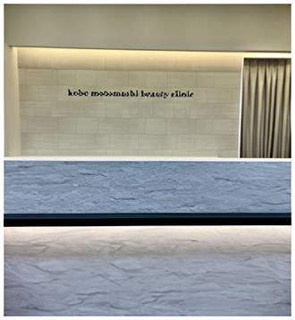 【シミ取りを神戸で】あなたに合う治療法が見つかる！クリニックの選び方と値段の目安