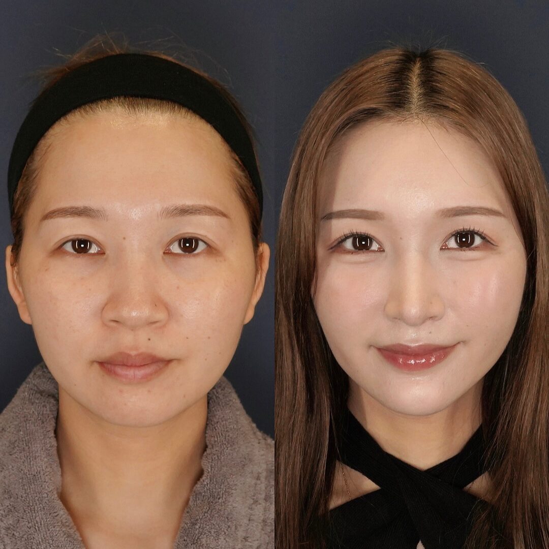 鼻の穴のコンプレックスからの卒業!LIVIN CLINIC院長が伝えるリアルストーリー | NERO DOCTOR/BERAUTY(美容医療メディア)