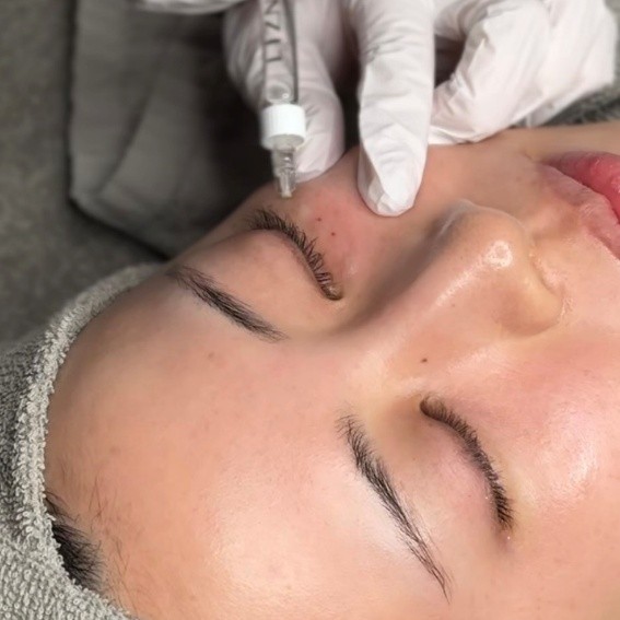 リトゥオを名古屋で受けるなら？特徴・リスクと注目クリニック5選をチェック｜NERO DOCTOR / BEAUTY（美容医療）