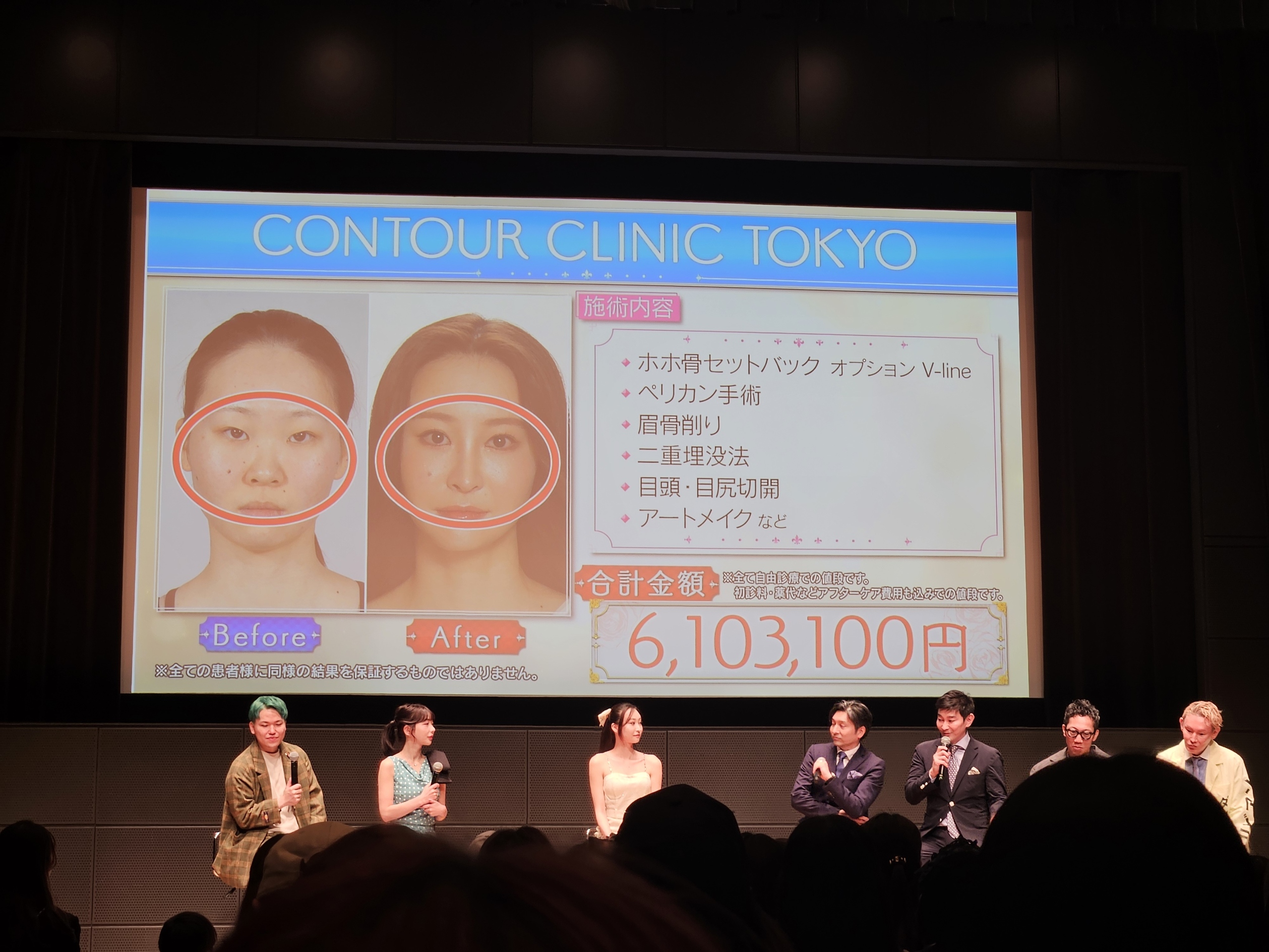 キララさんとRちゃんのトークセッション