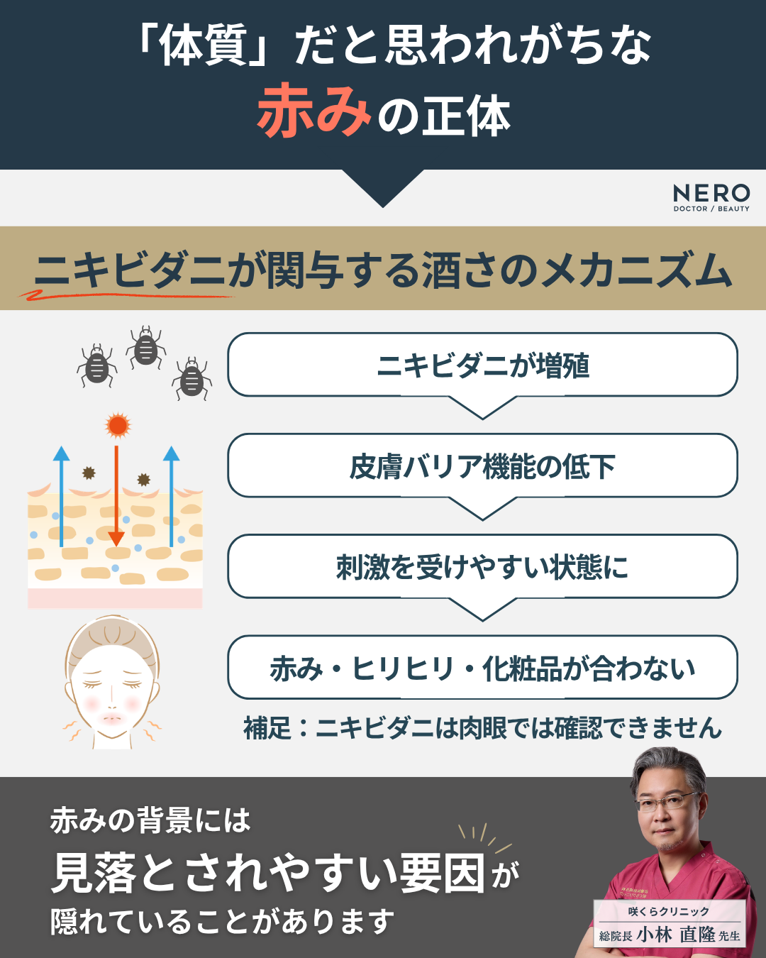 酒さは“一生治らない”？セカンドオピニオンという選択肢｜NERO DOCTOR/BEAUTY(美容医療メディア）
