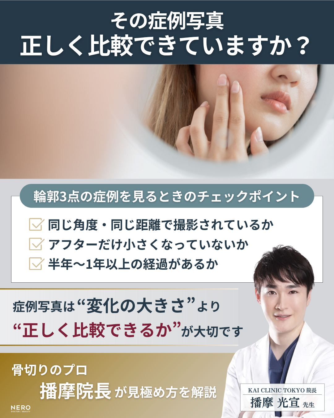 【医師監修】輪郭3点とは？骨切り設計の秘訣｜NERO美容医療
