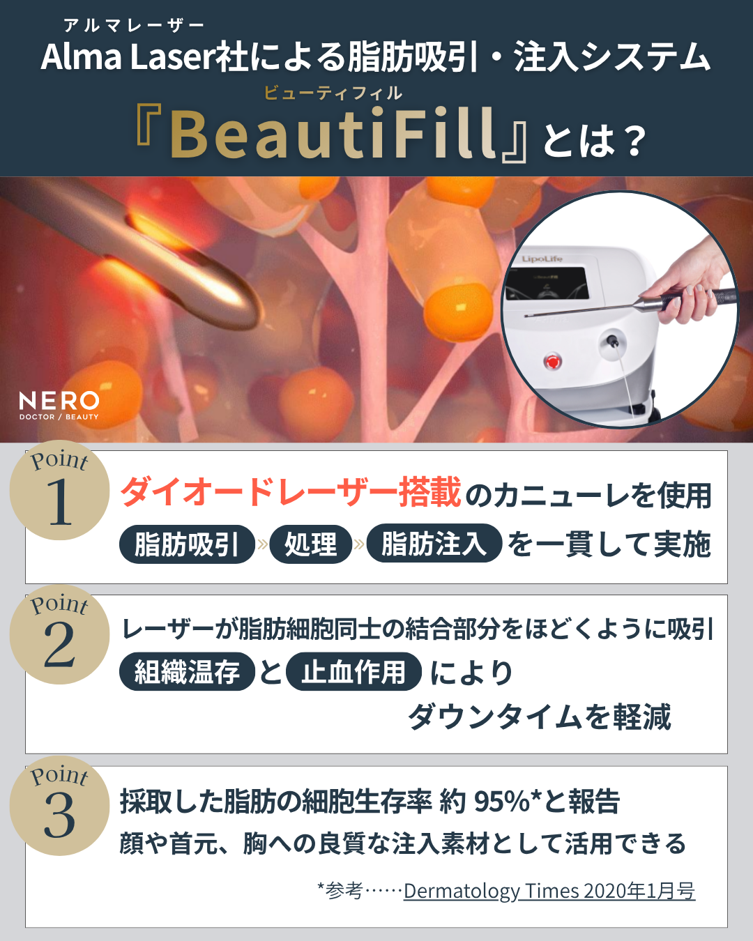 BeautiFill（ビューティフィル）が切り拓く脂肪治療の新時代──LipoLife（ライポライフ）で実現する“脂肪は削るものから生かすもの”へという転換【BIANCA CLINIC幡手 亜梨子医師監修】