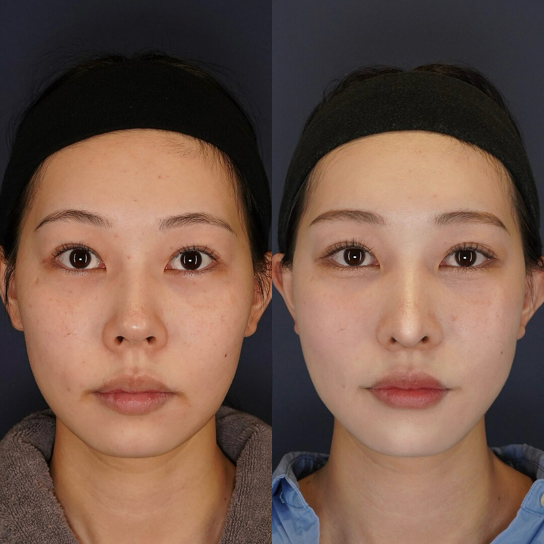 鼻の穴のコンプレックスからの卒業!LIVIN CLINIC院長が伝えるリアルストーリー | NERO DOCTOR/BERAUTY(美容医療メディア)