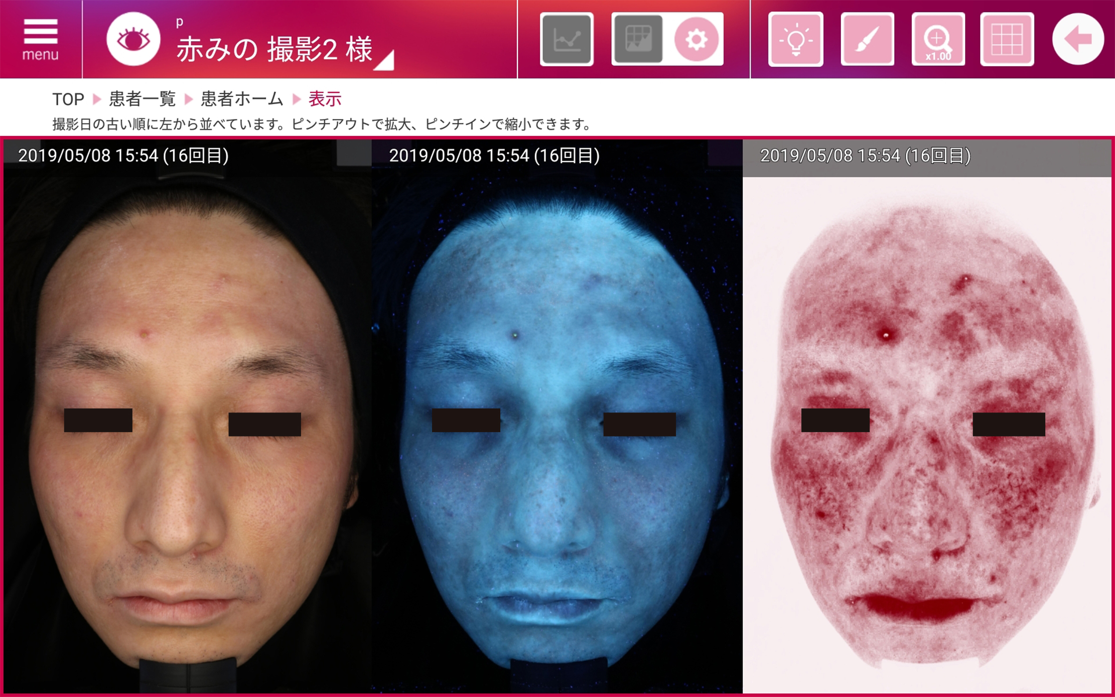 【医師インタビュー】シミ取り福岡・美容皮膚科担当医｜NERO美容医療