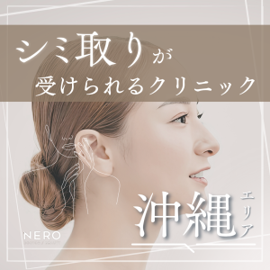 シミ取りを沖縄でするなら知っておきたいポイントをチェック！シミの種類や治療法・クリニック選びの基準とは