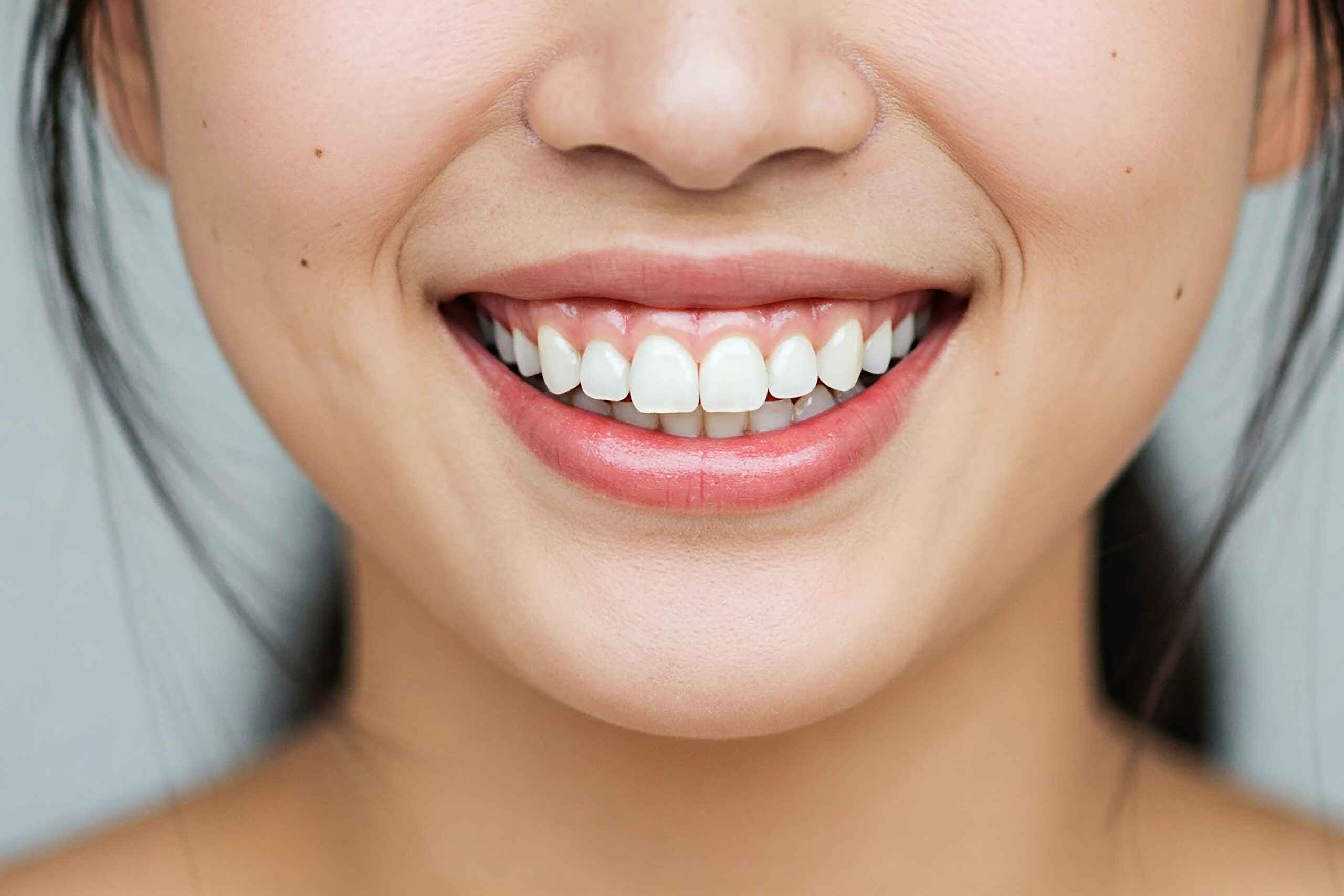 白い歯「削らないラミネートベニア」ブームから考える“白い歯の基準”とは？【ブラックフィルム】【ゼロネイト】時代の審美観｜NERO DOCTOR / BEAUTY（美容医療）