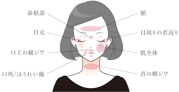 ベビーコラーゲン注入とは？名古屋で自然な若見えを叶える効果・持ち・失敗を徹底解説｜NERO DOCTOR / BEAUTY（美容医療）