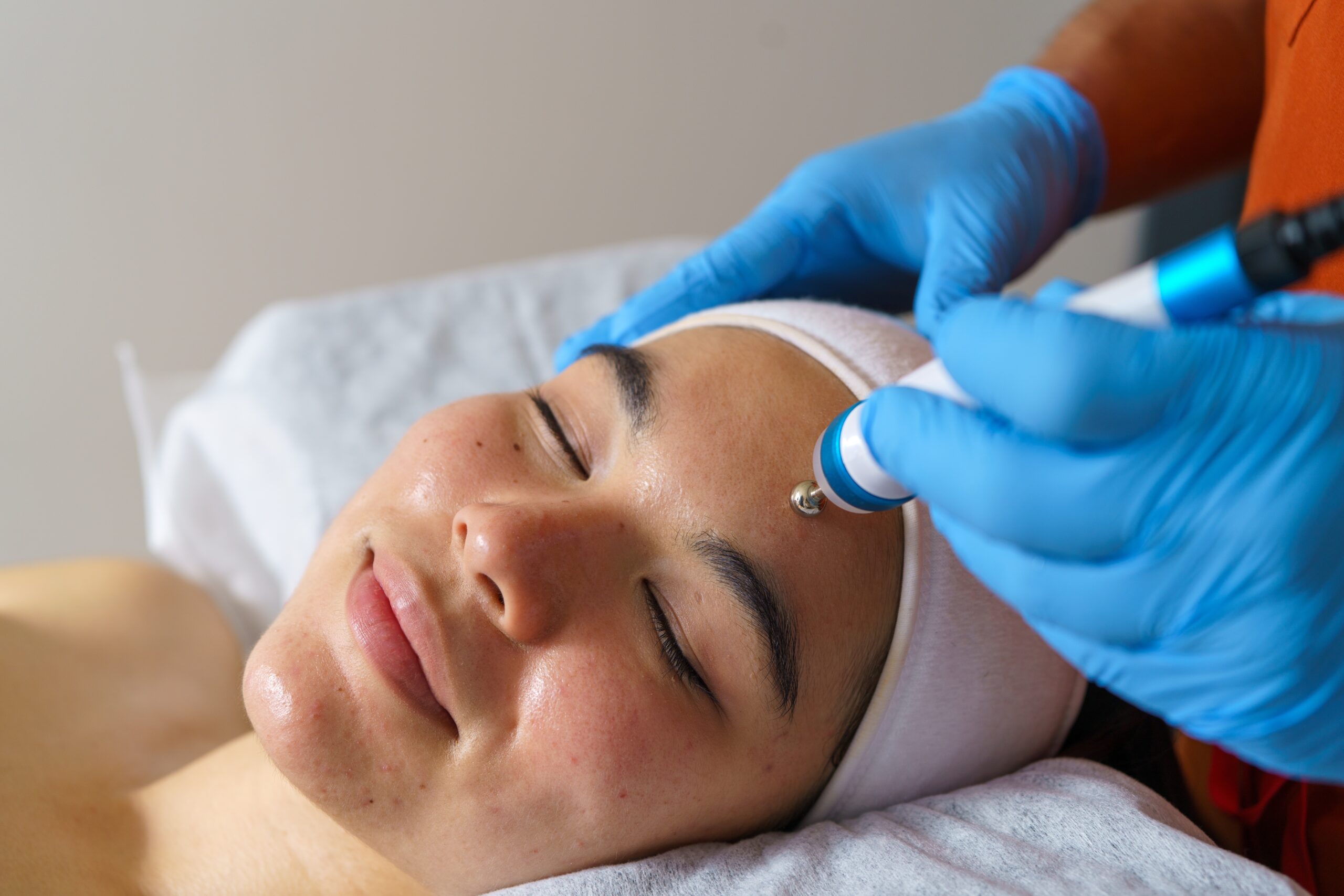 ニキビに悩む30代へ｜治りにくい理由と美容医療でできるケア｜NERO DOCTOR / BEAUTY（美容医療）