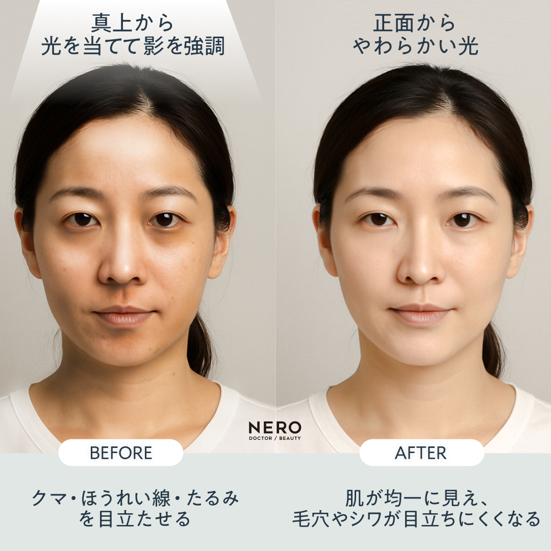 After写真を良く見せようとする症例写真の一例