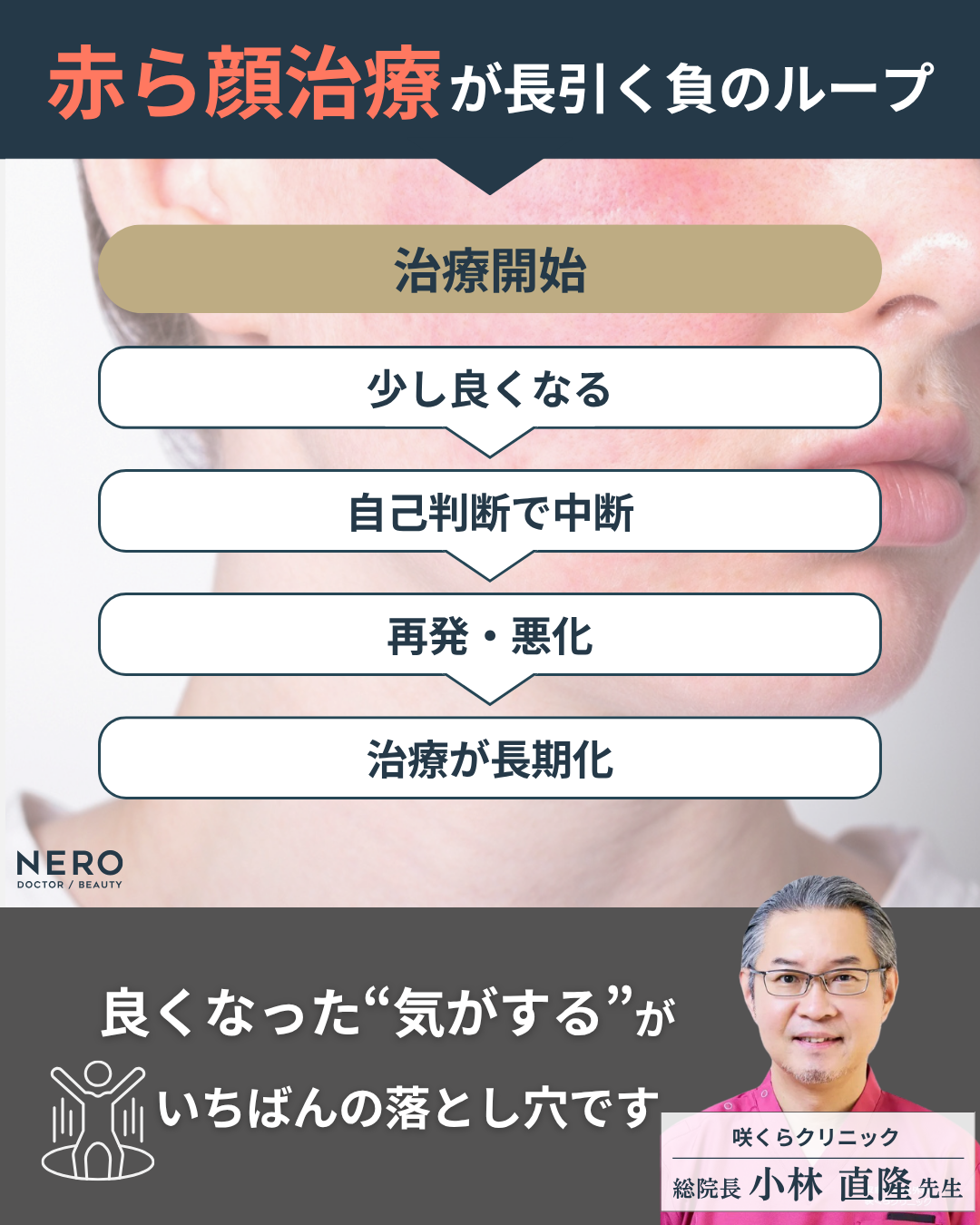 顔の赤みの原因は自己流スキンケアに潜む？効果的な治療は正しい診断から！
