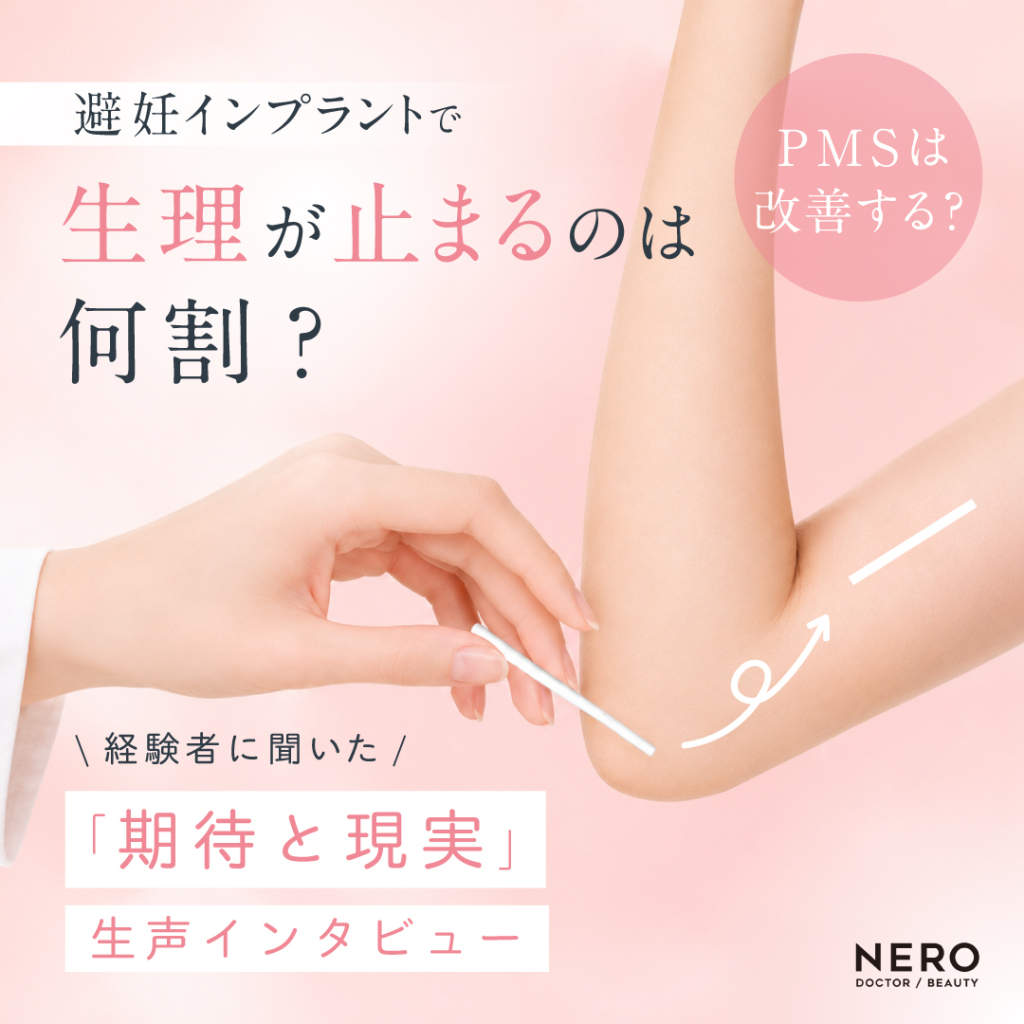避妊インプラントで生理は止まるのは【ズバリ何割？】PMSは改善する？経験者に聞いた「期待と現実」生声インタビュー