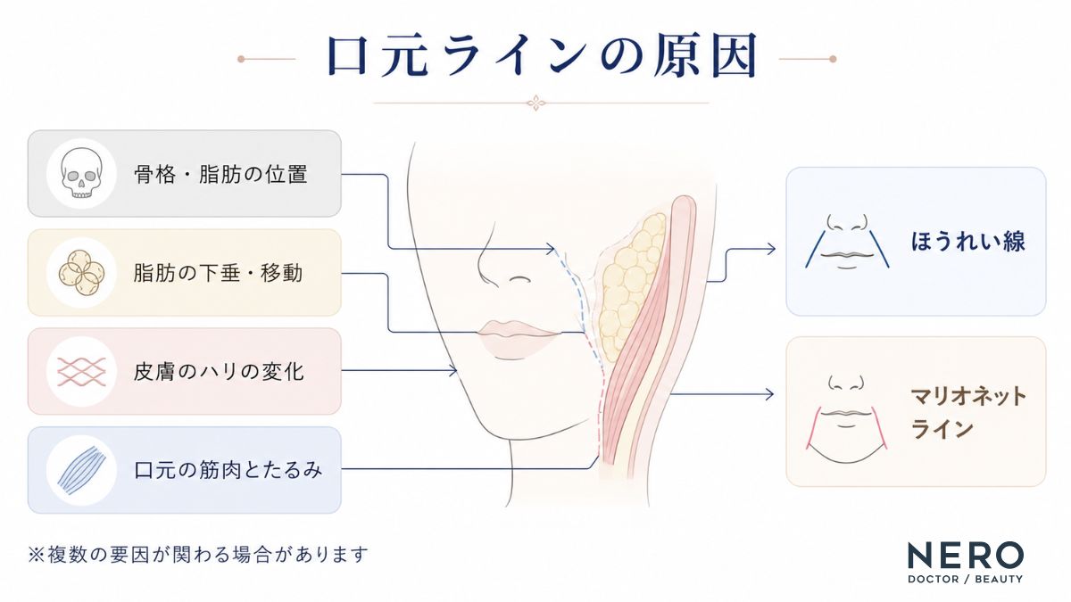 口元のラインに関わる主な原因を整理した概念図