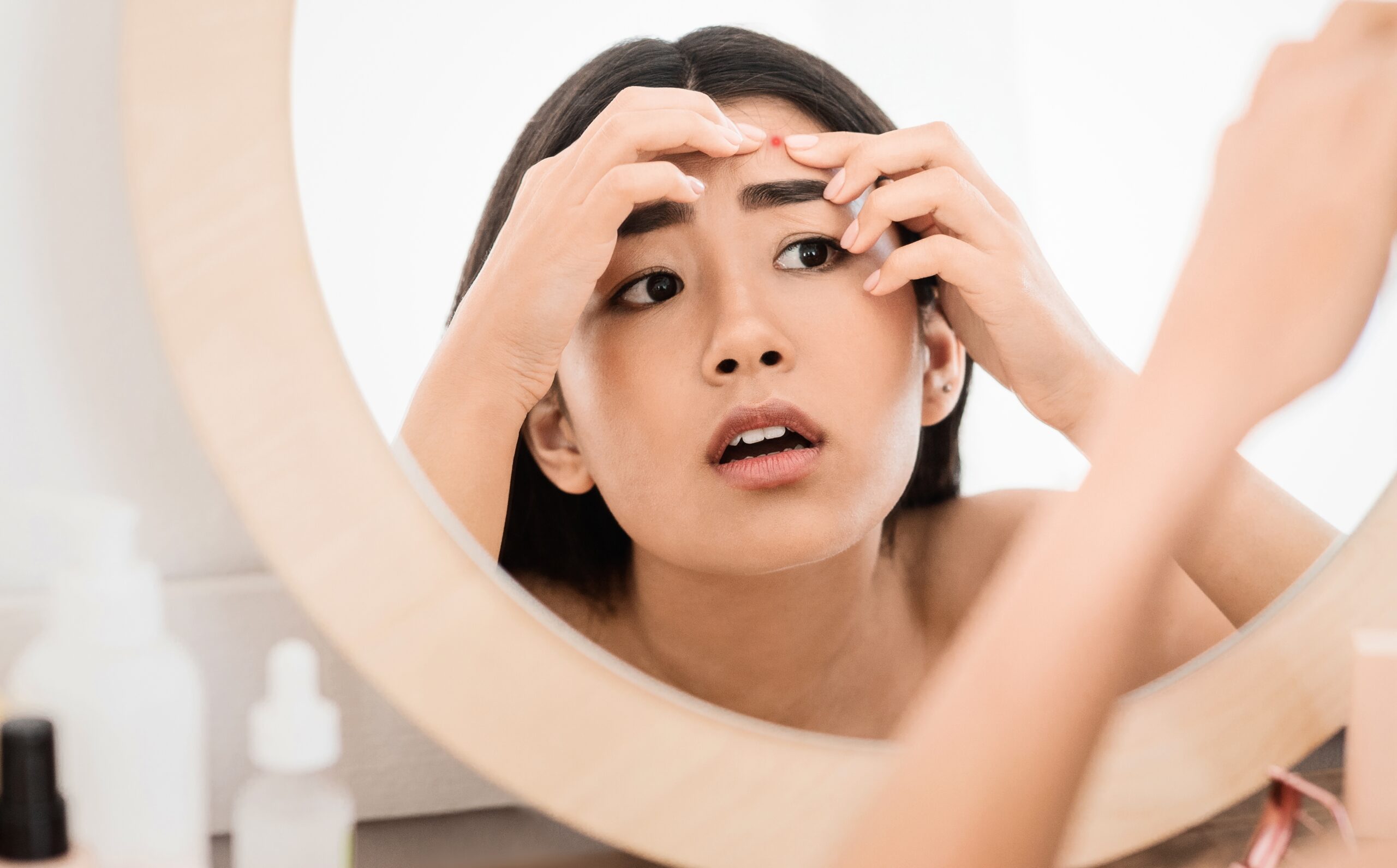 ニキビや皮脂詰まりによる肌悩みを確認する女性の美容医療イメージ写真
