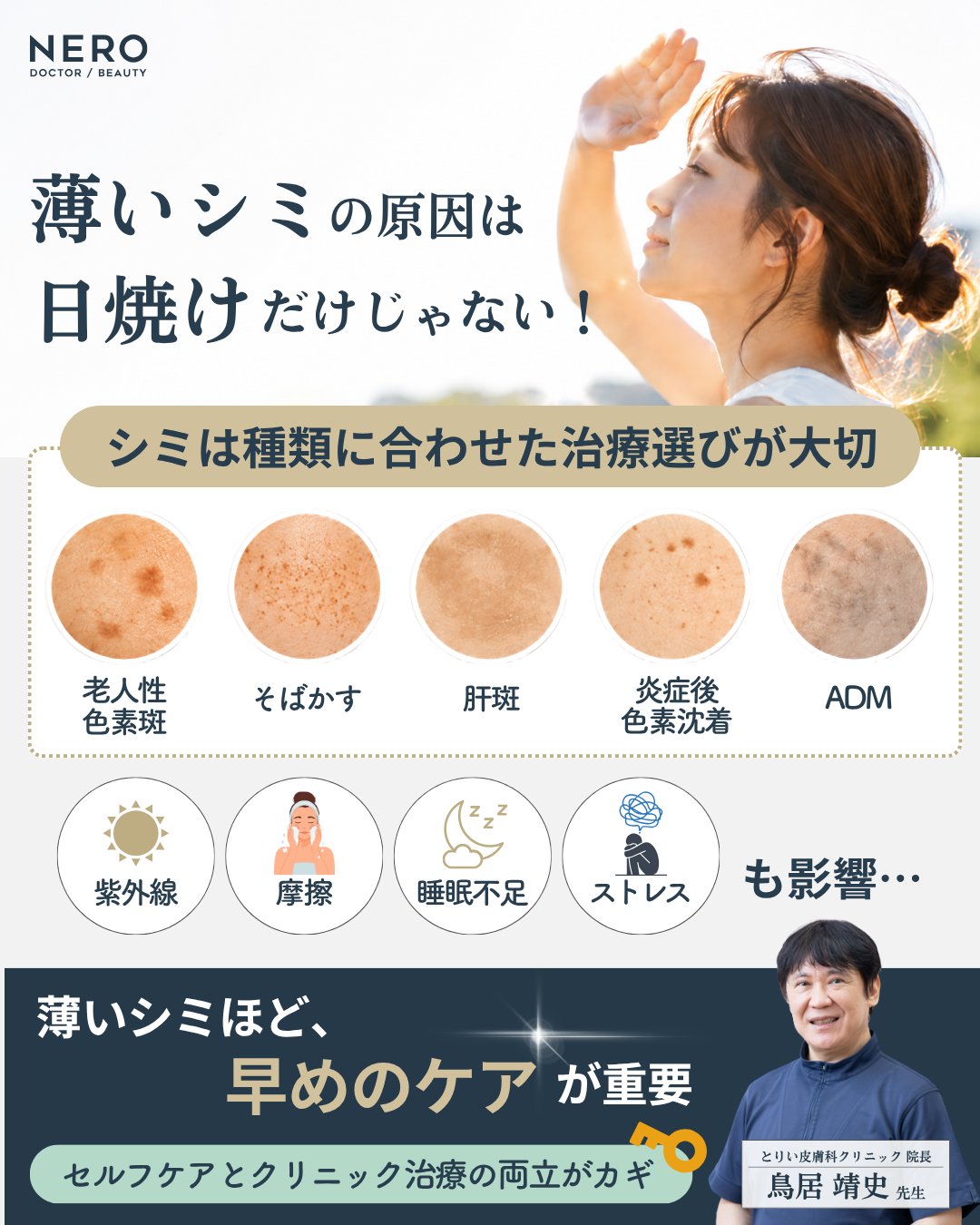 薄いシミの原因は日焼けだけではない。シミの種類に合わせた治療選びと、早めのケアの重要性をとりい皮膚科クリニック院長・鳥居医師が解説