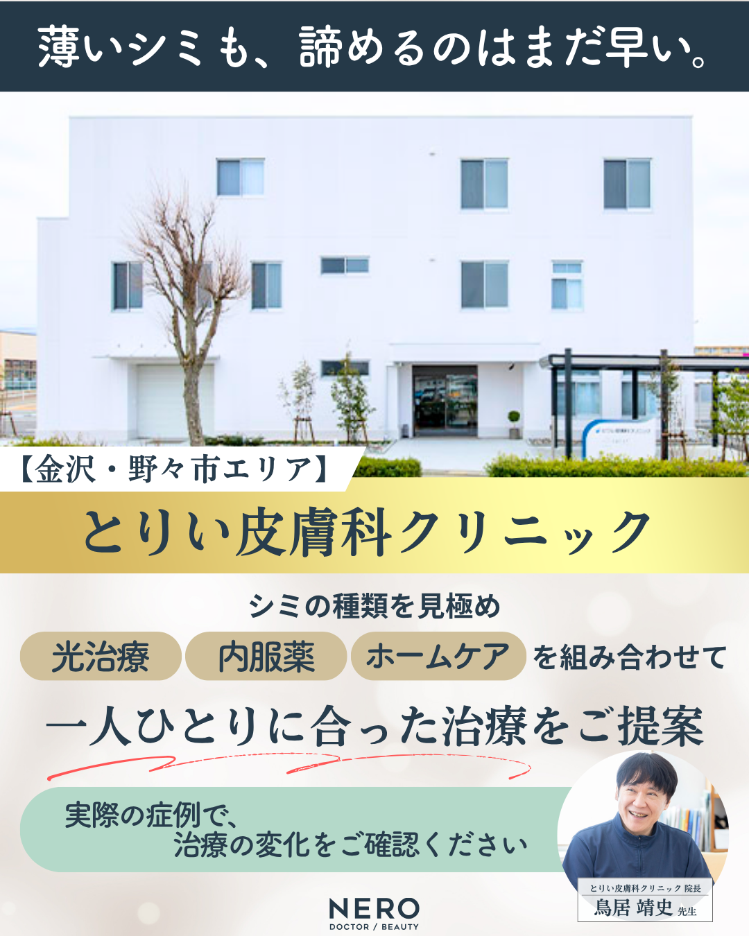 シミの種類を見極め、一人ひとりに合った治療を提案する金沢・野々市エリア「とりい皮膚科クリニック」の症例紹介