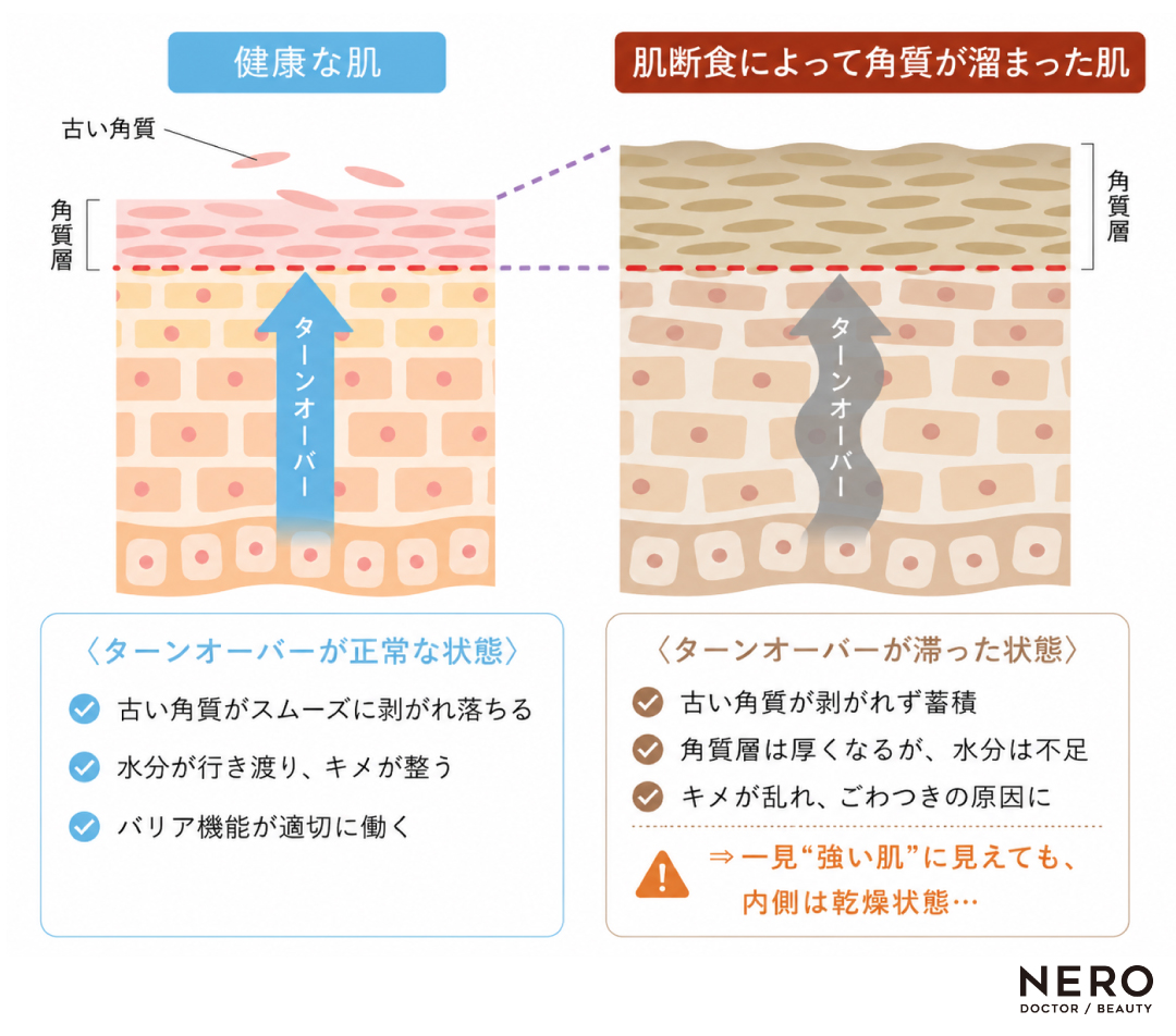 ターンオーバーについて説明する図｜健康な肌と肌断食によって角質が溜まった肌の違い