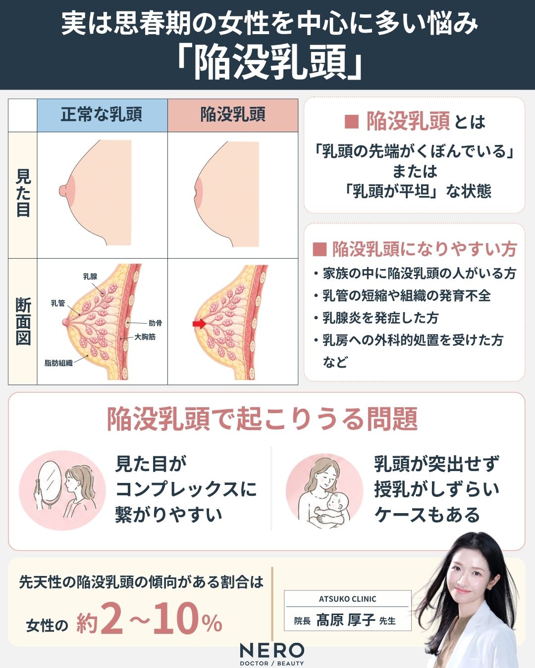 陥没乳頭とは何かを説明する画像