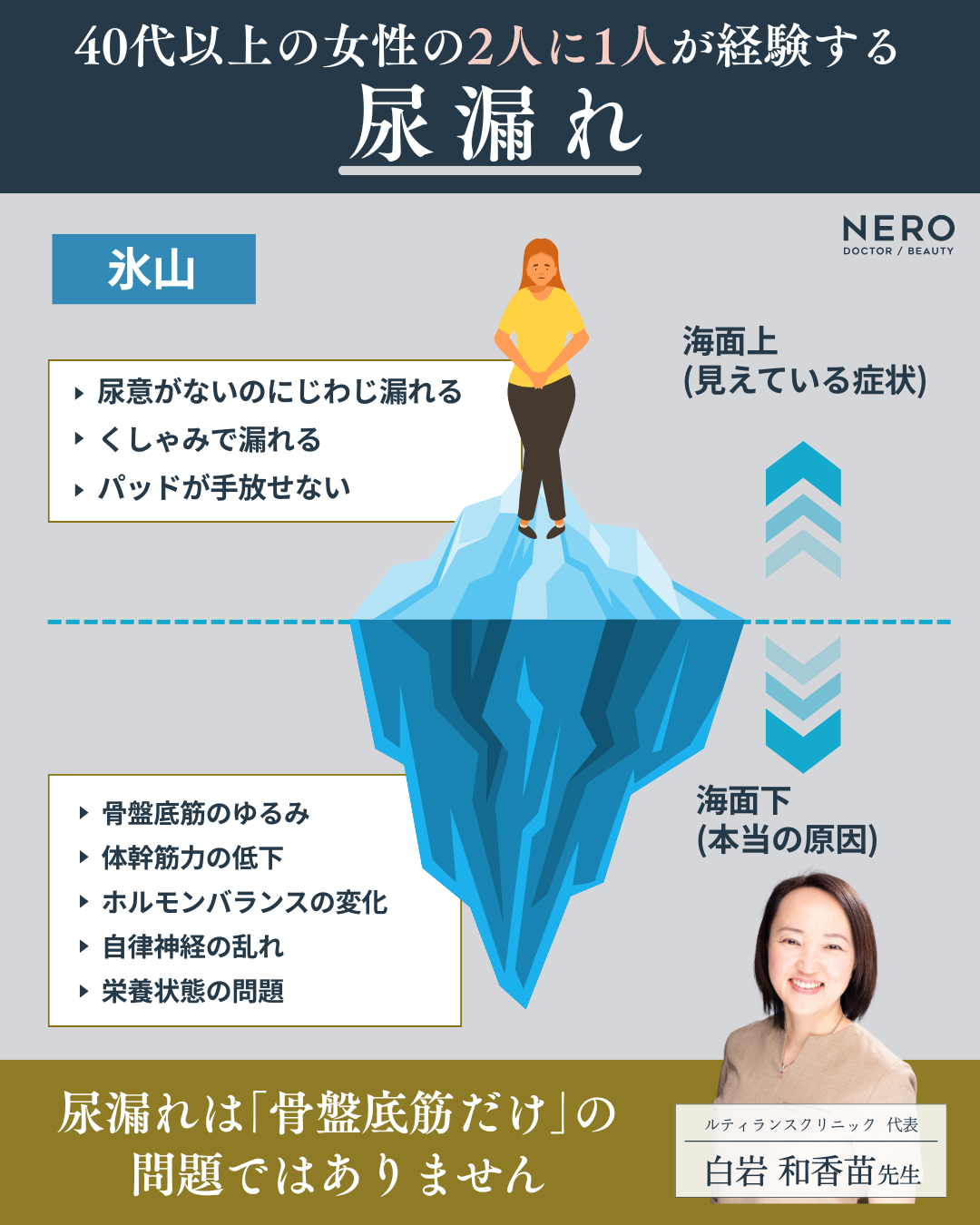 尿漏れの原因図解イメージ
