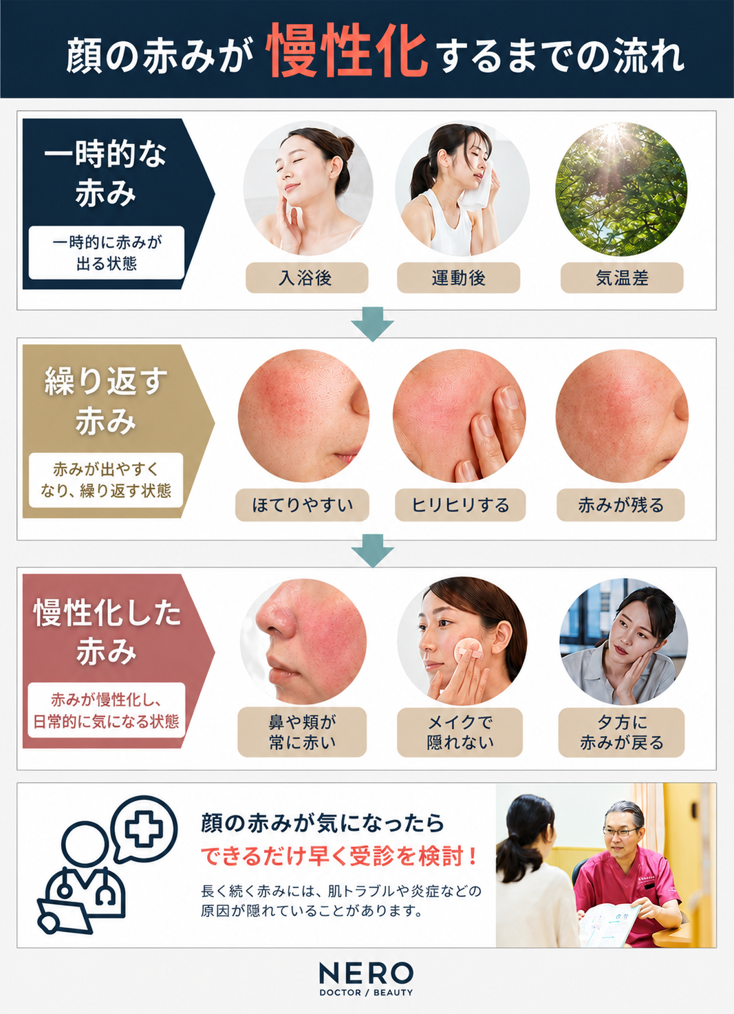 顔の赤みが慢性化するまでの流れを示した図