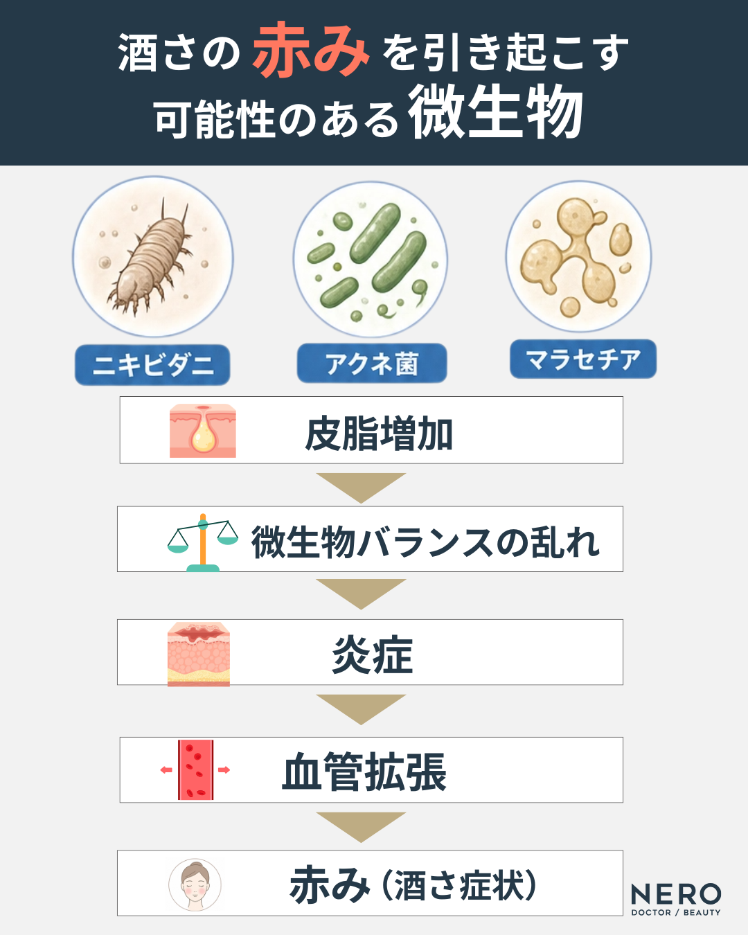 酒さの赤みを引き起こす主な微生物はニキビダニとアクネ菌、マラセチア