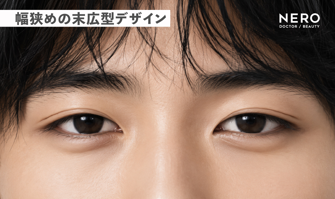メンズ二重整形｜幅狭めの末広二重デザインの画像