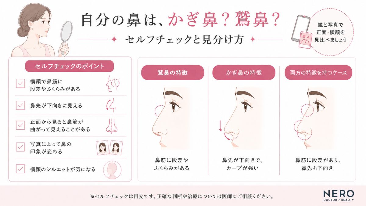 かぎ鼻と鷲鼻のセルフチェックポイントをまとめた図