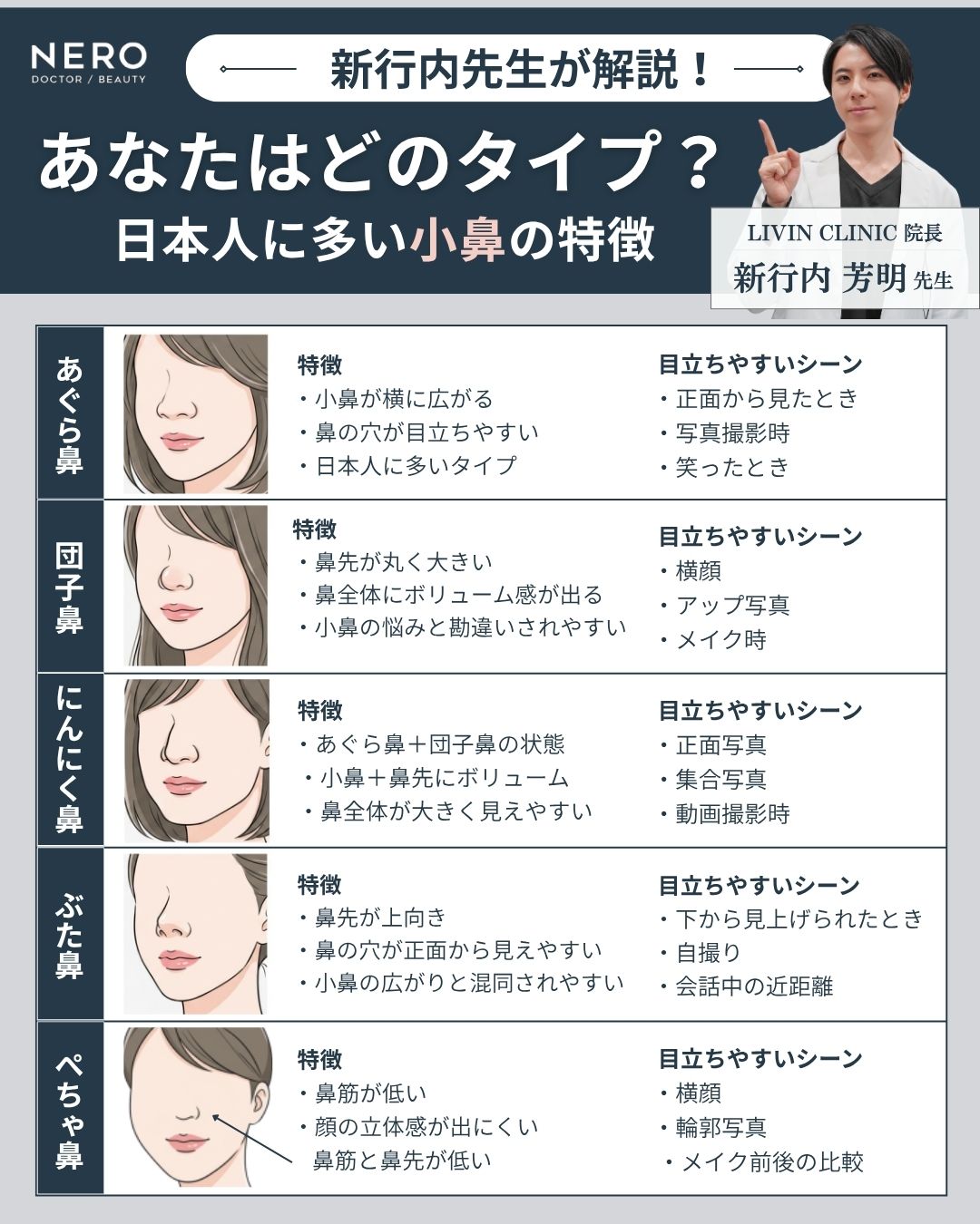 日本人に多い小鼻の特徴を解説